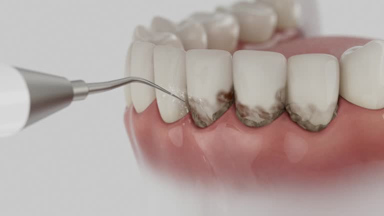 Trusted Emergency Dentist service in Columbiana, OH - Dentist Open Now